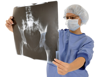 Ärztin mit Röntgenaufnahme vor Hüftoperation