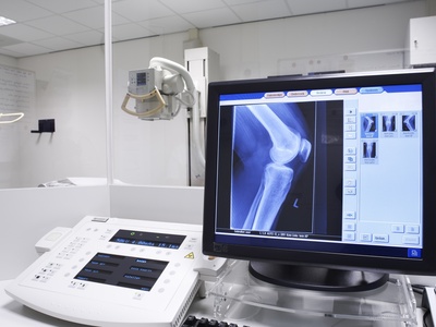 Röntgenbild des Kniegelenk