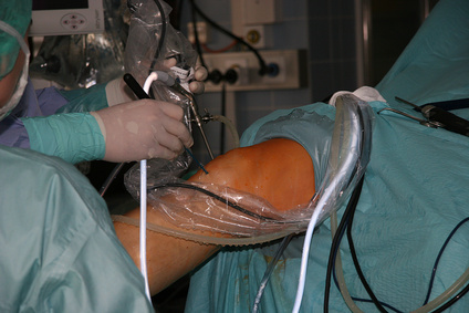 Minimal-invasive Knieoperation, arthroskopische Schlüsselloch-Technik